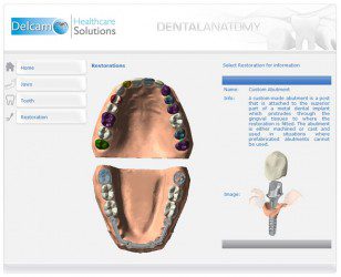 Delcam DentCAD 2012.1