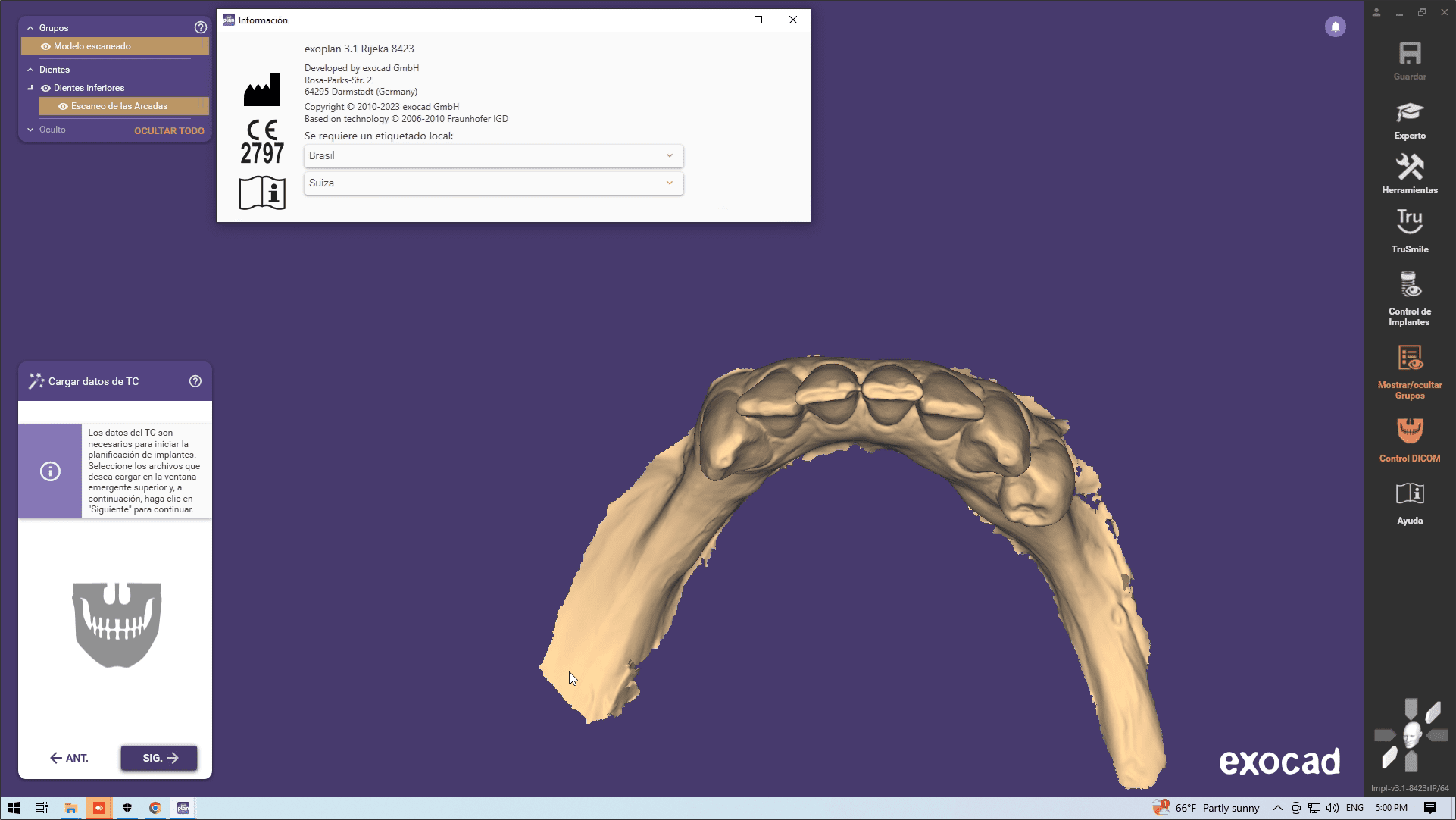 Exocad exoplan 3.1 Rijeka 8423, exocad exoplan DB 3.1 Rijeka 8423 Multilingual